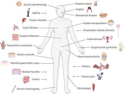 Melanocortin therapies to resolve fibroblast-mediated diseases
